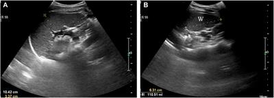 Eight weeks of dry dynamic breath-hold training results in larger spleen volume but does not increase haemoglobin concentration